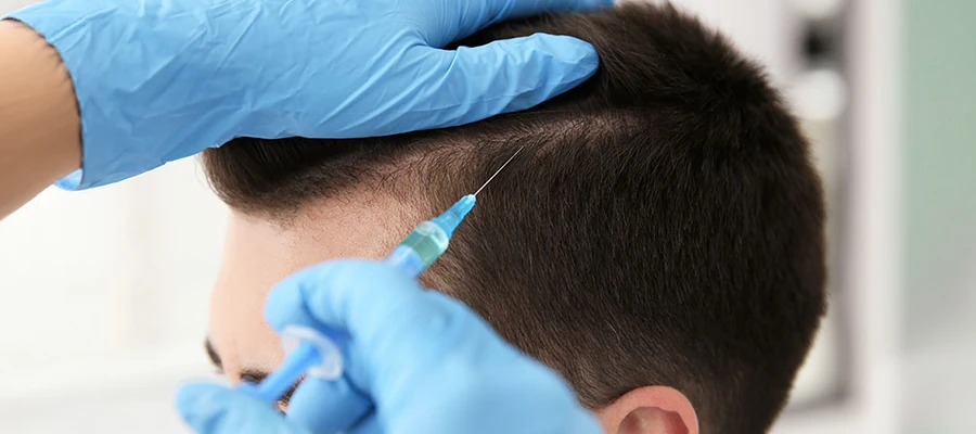 Hair Stem Cell Therapy