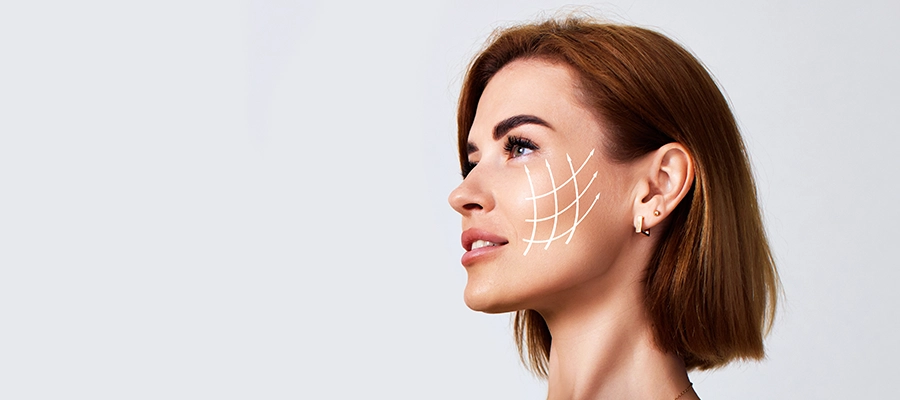 Sculptra